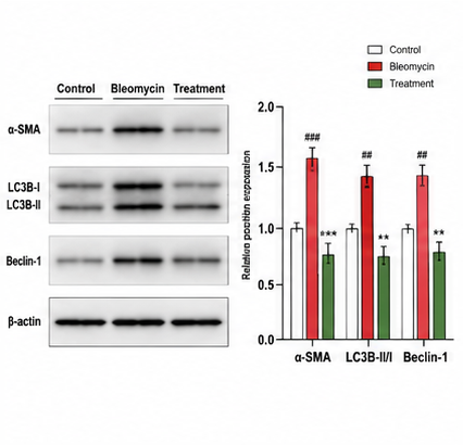 Western Blot α-SMA LC3B 결과 예시