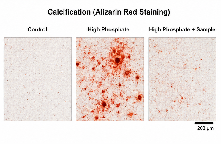 VSMC Calcification Alizarin Red Staining 예시