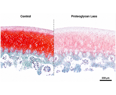 Safranin O proteoglycan loss 비교 이미지