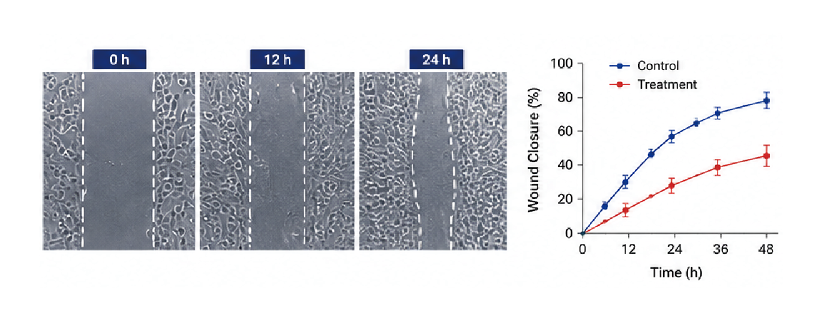 Scratch assay wound healing 분석 예시 이미지