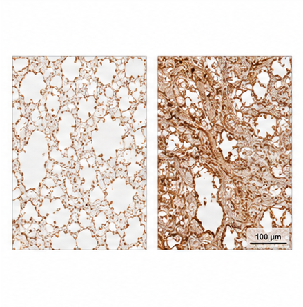 Collagen I IHC 결과 예시