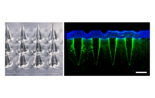 Microneedle skin penetration 결과 예시