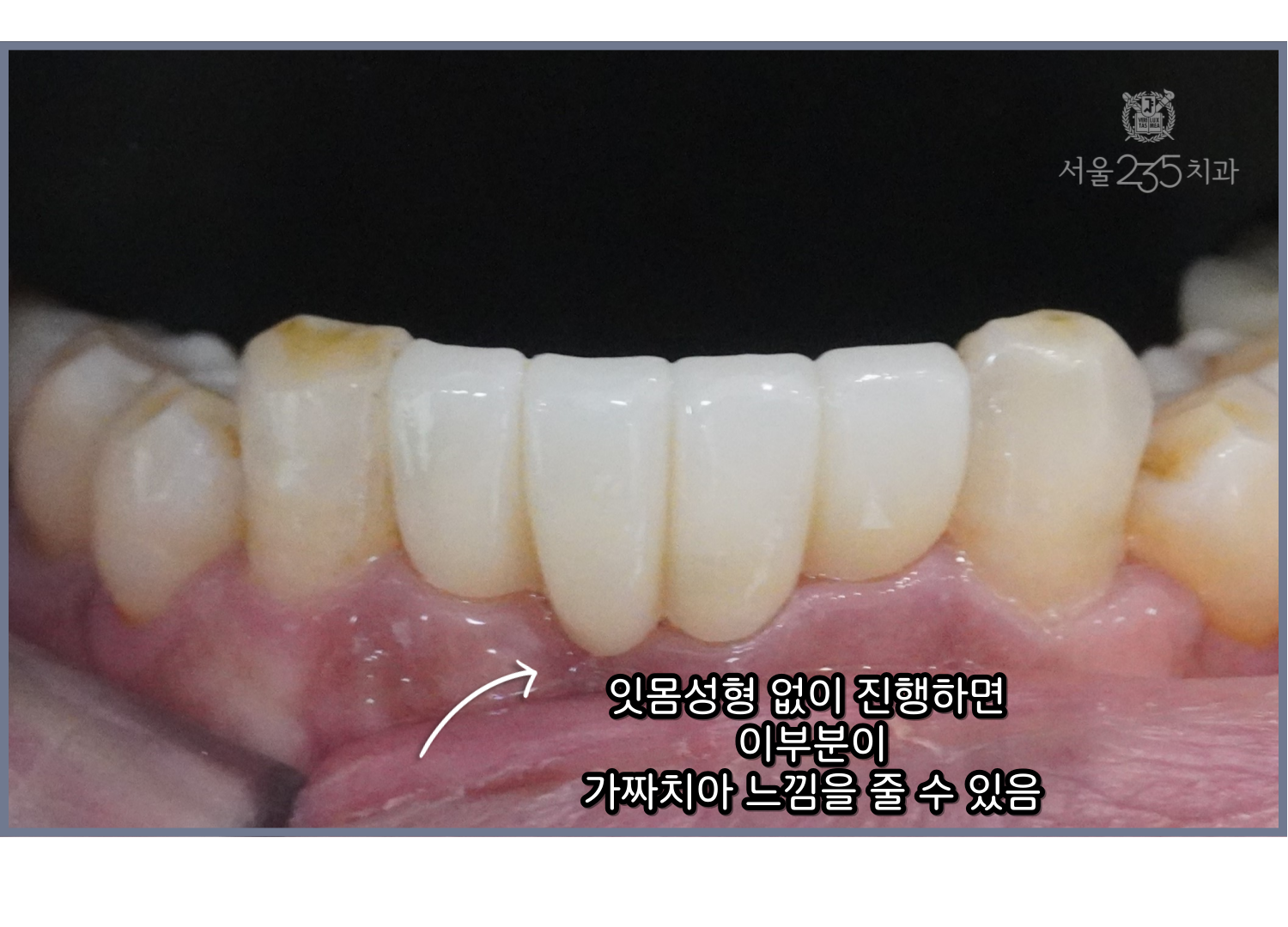 0290ed140c243.png