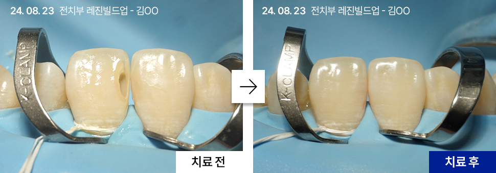 02cb9e07aa38d.png