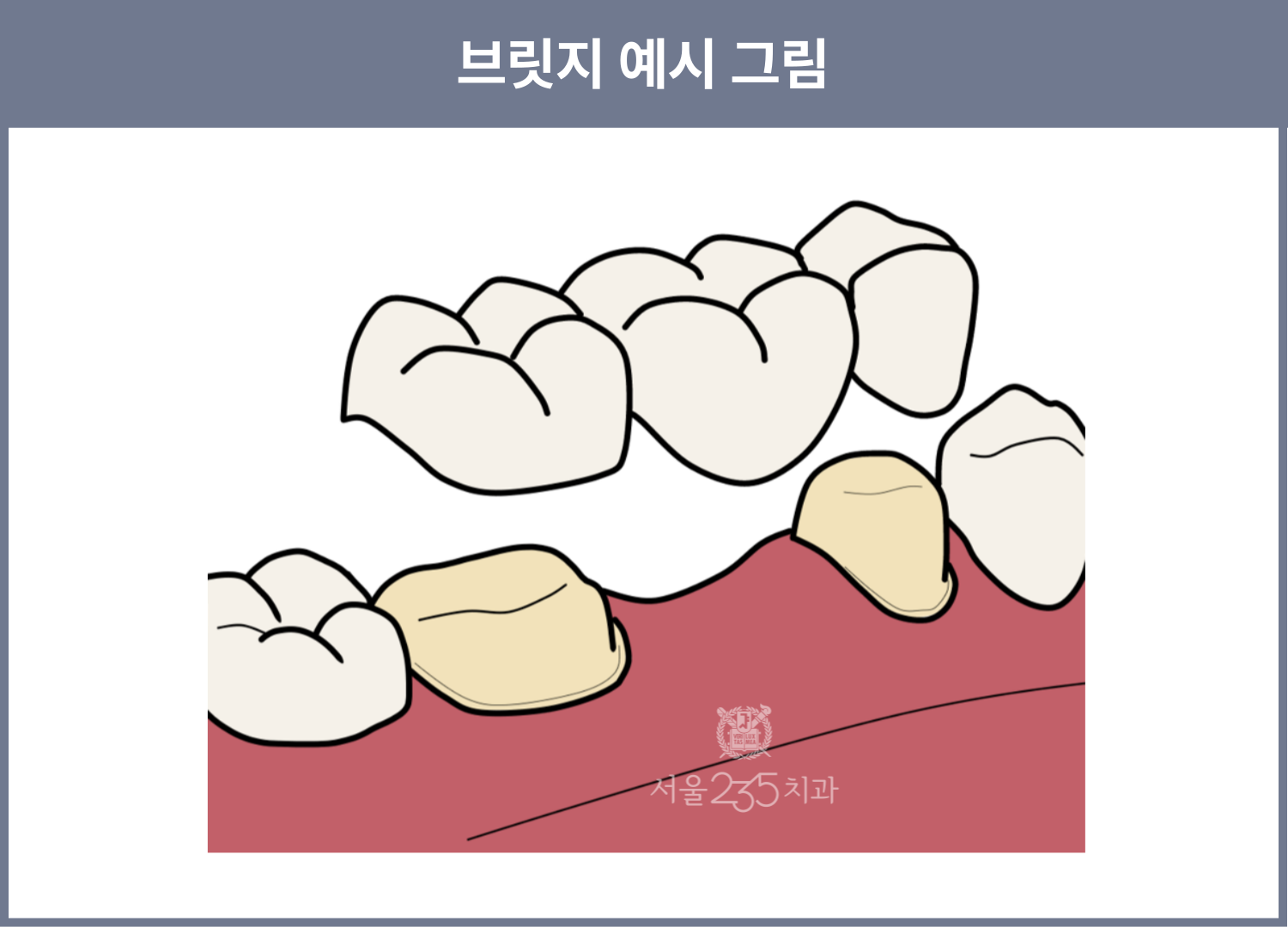 07776ba93570a.png