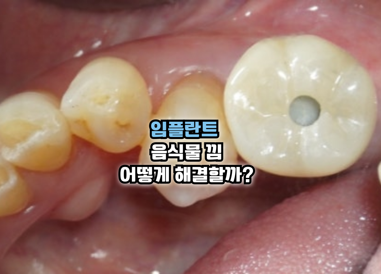 087a386ba8f06.png