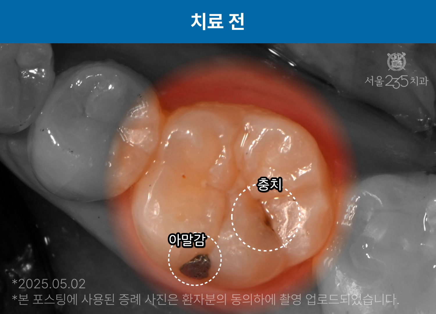 208d4825196be.png