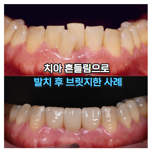 2f2cedc927b14.png