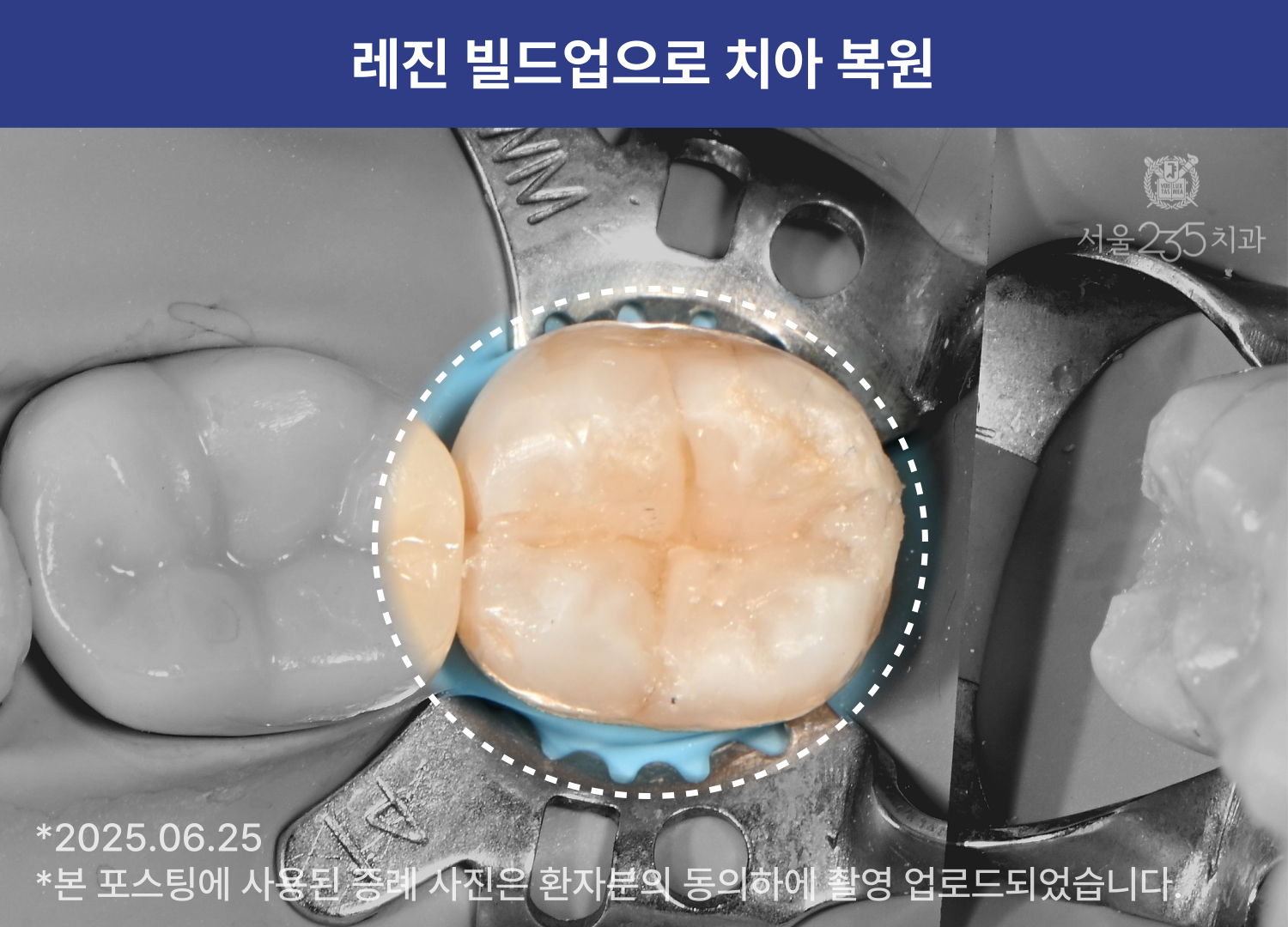 4afed5cce4317.png