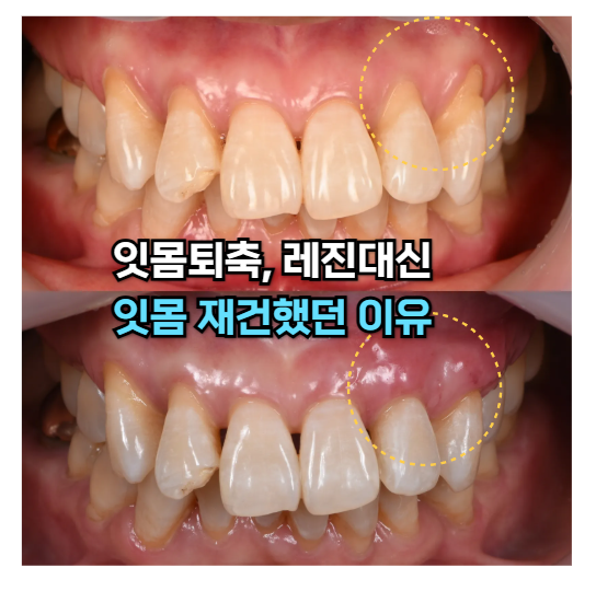 5eb868f03c384.png