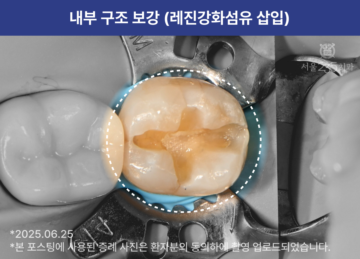 646a2482b8c9a.png