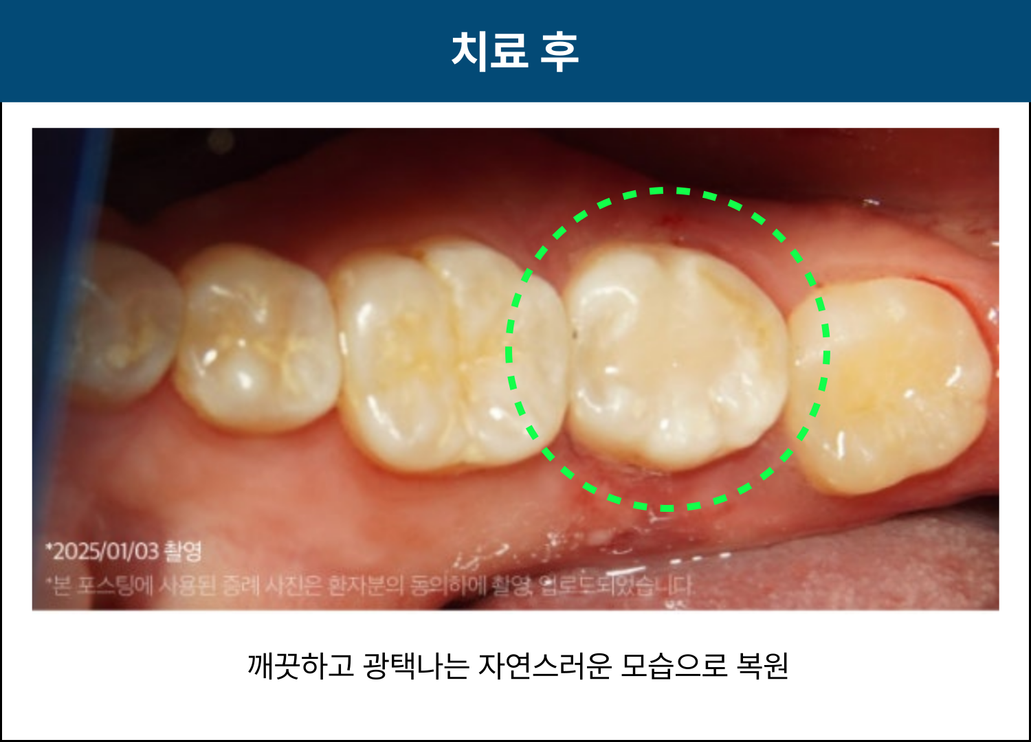 90baef8a43581.png