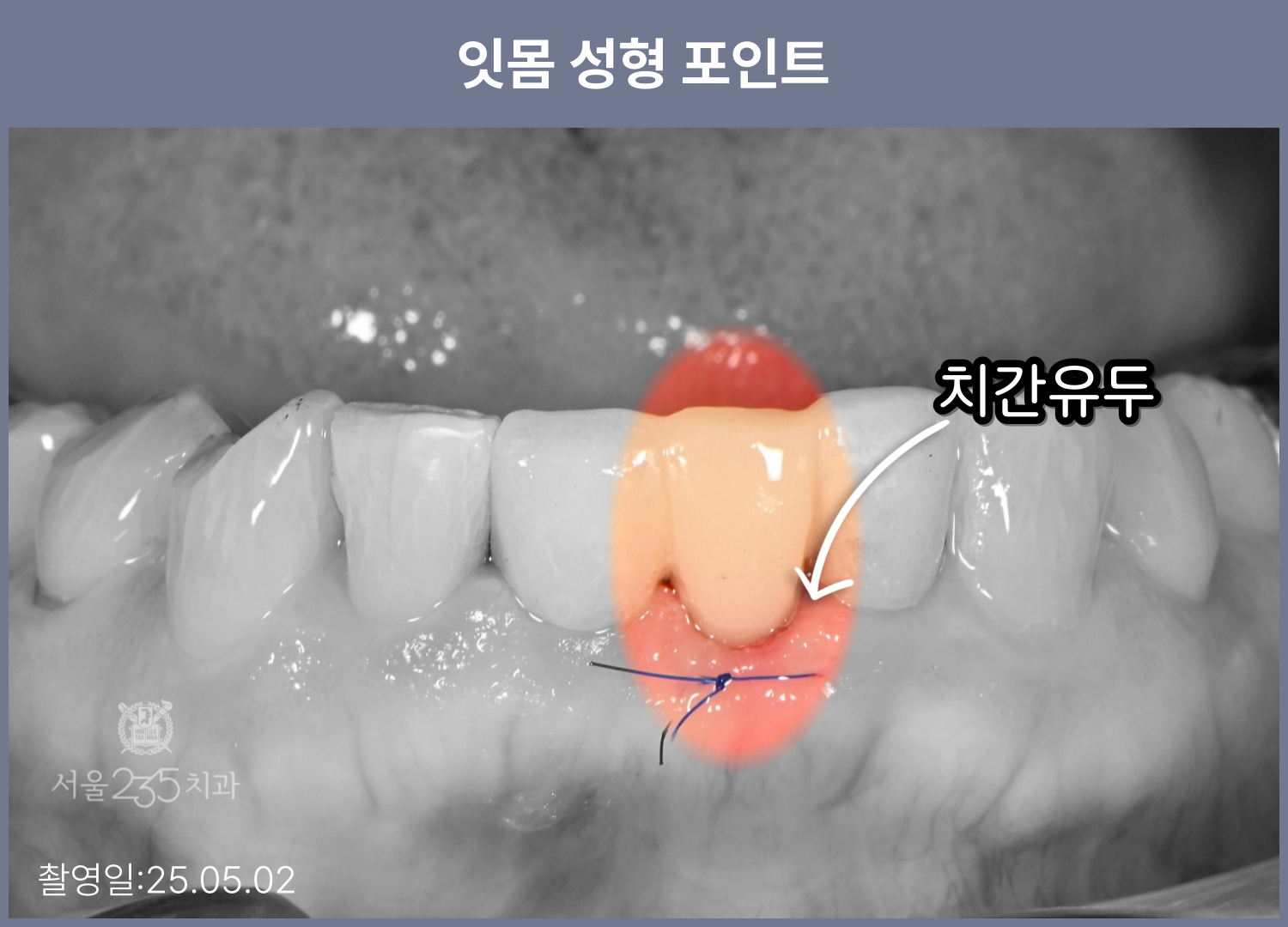 a017b8a81cffe.png