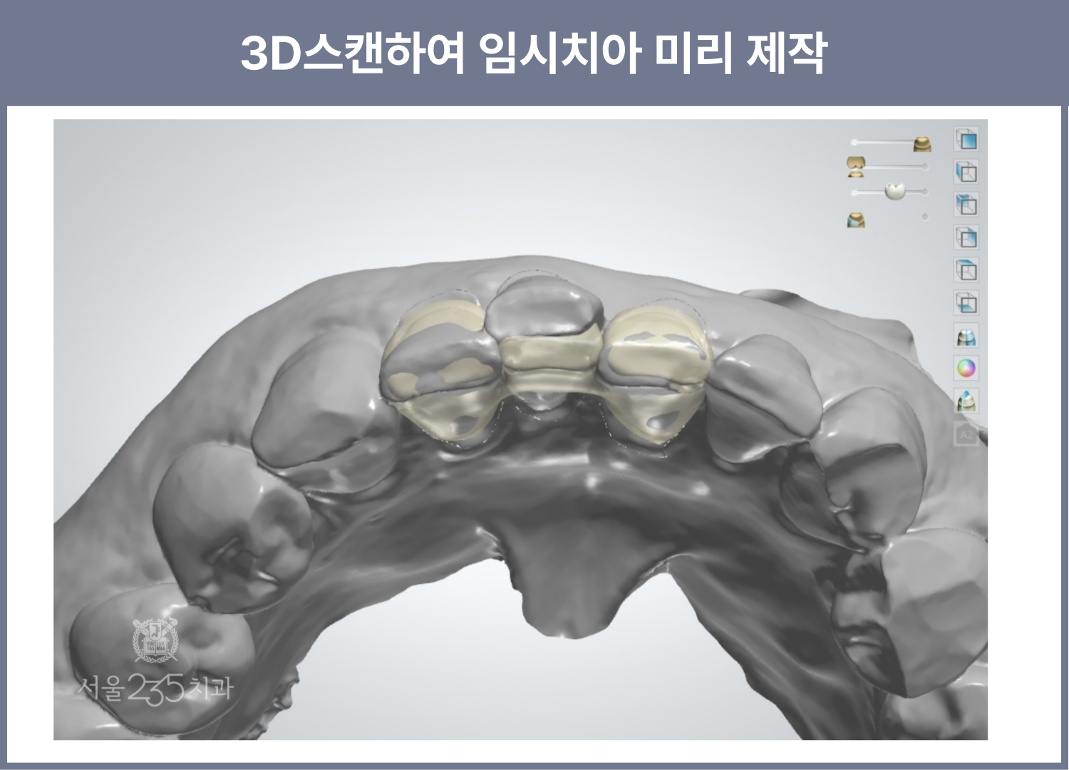 d78bec6071be3.png