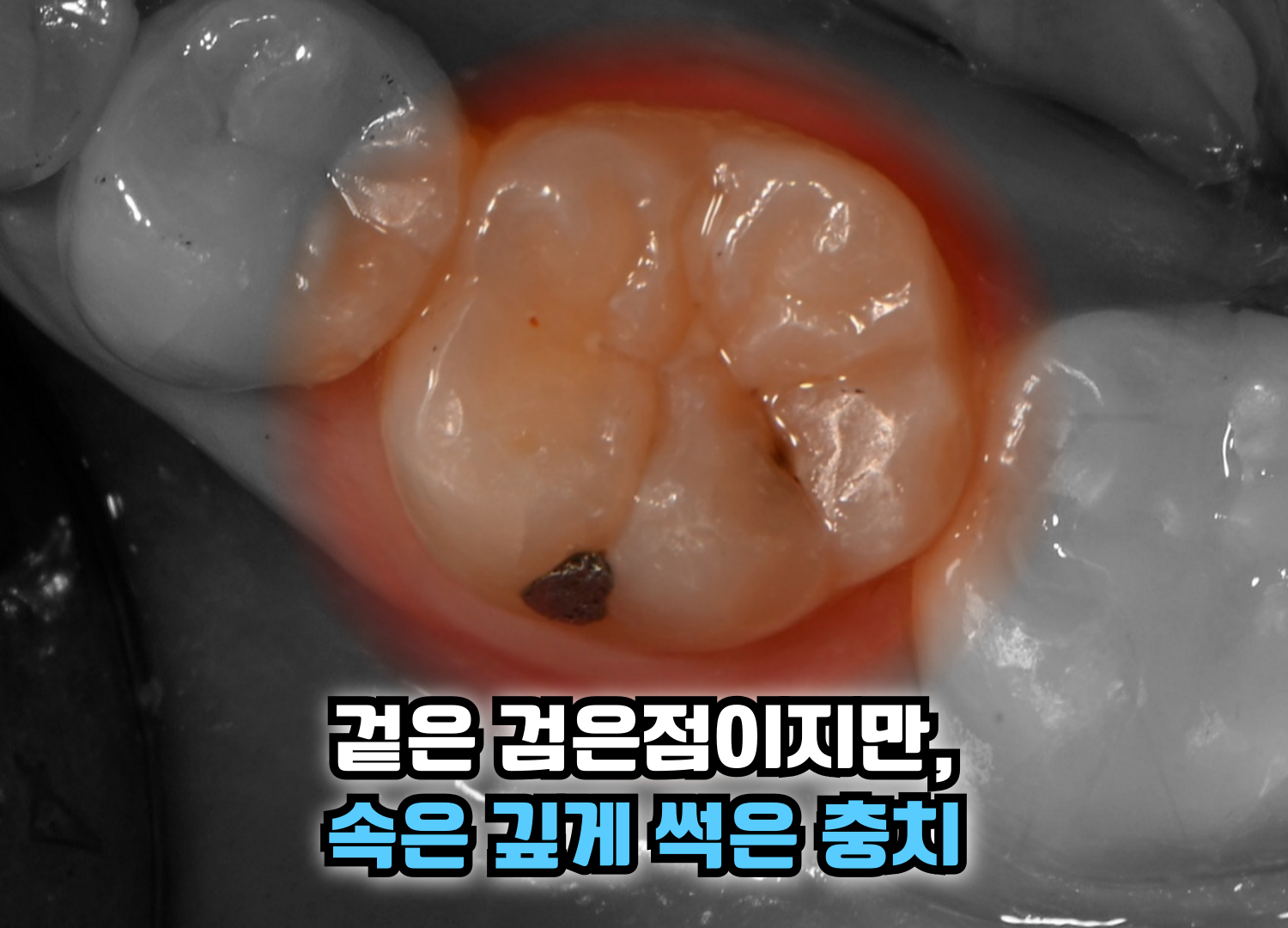 dcedcd4190c86.png