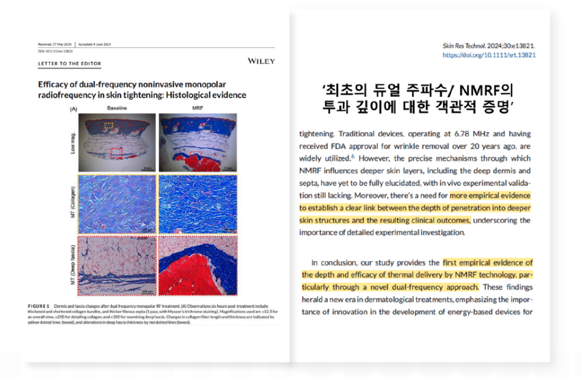 b764918fb846e.png
