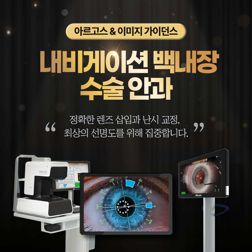 내비게이션 백내장 수술