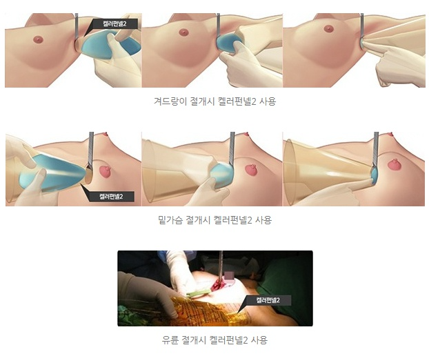 f8efc2d5ae087ea183967e6ae138737b_1504191