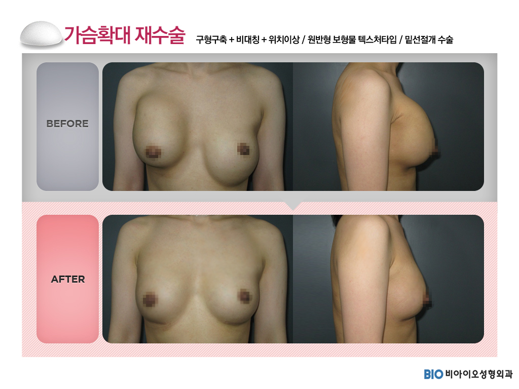 a39133be1189b.jpg