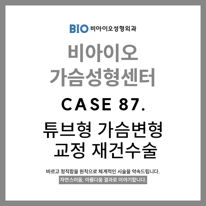 bdc4a5538aa9c.jpg