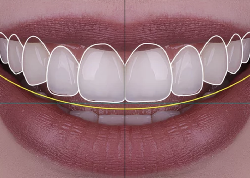상담 및 진단자료 채득