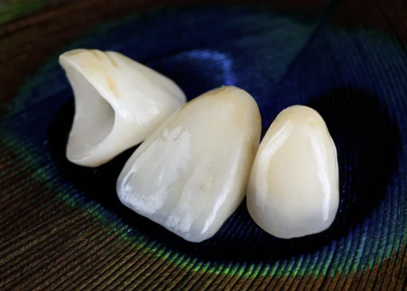 올세라믹 크라운