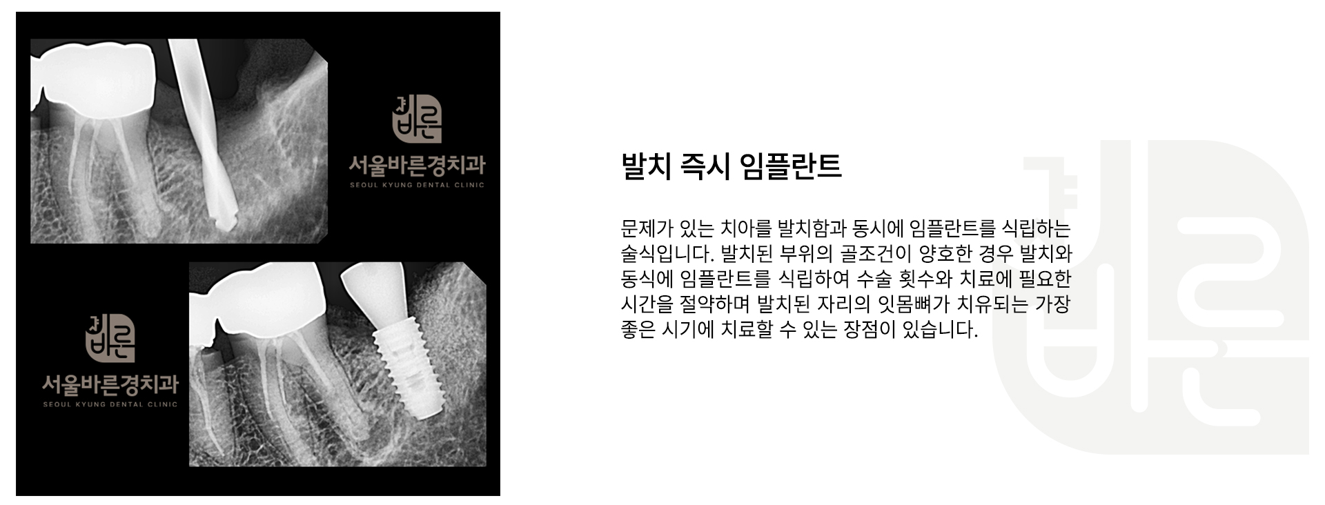 슬라이드 3
