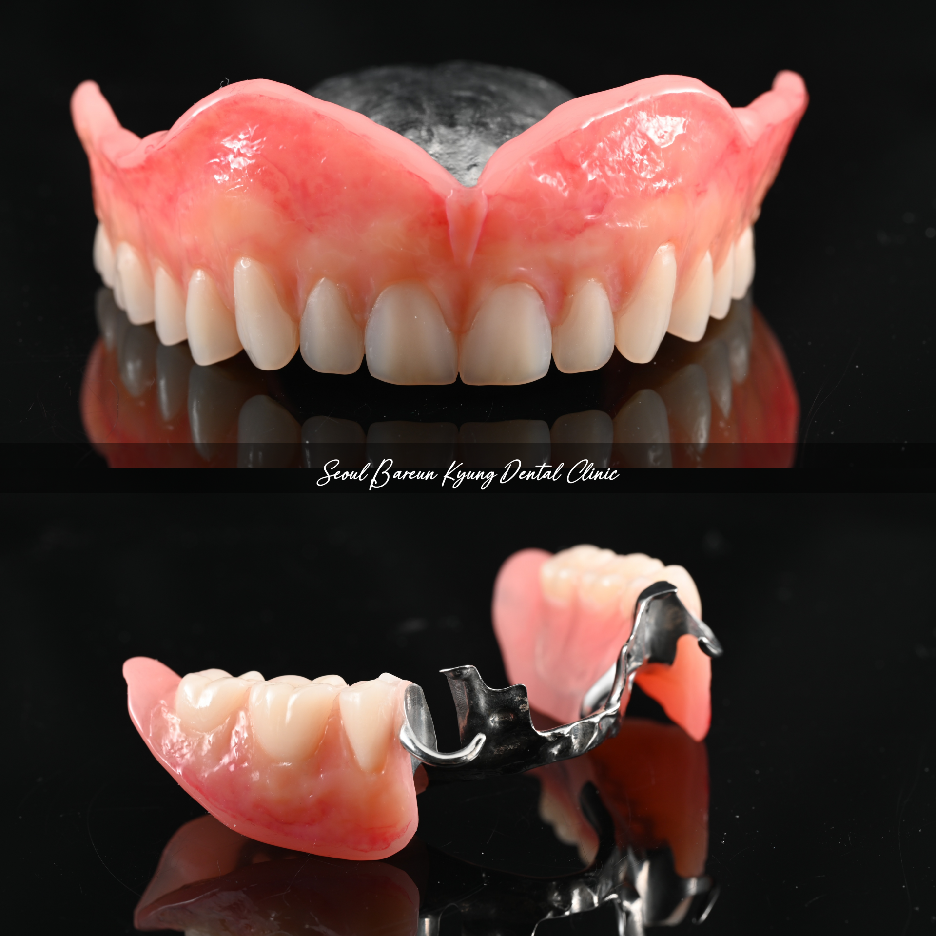 틀니치료 이미지