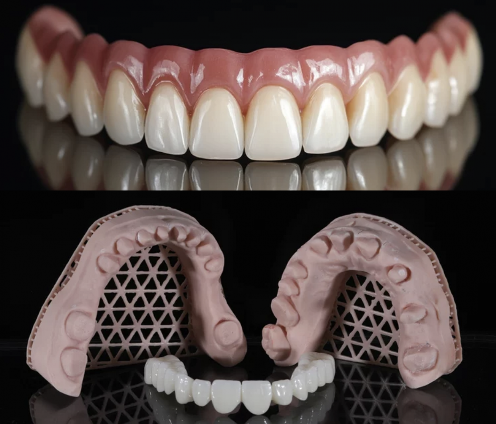 치열 재건(보철치료)