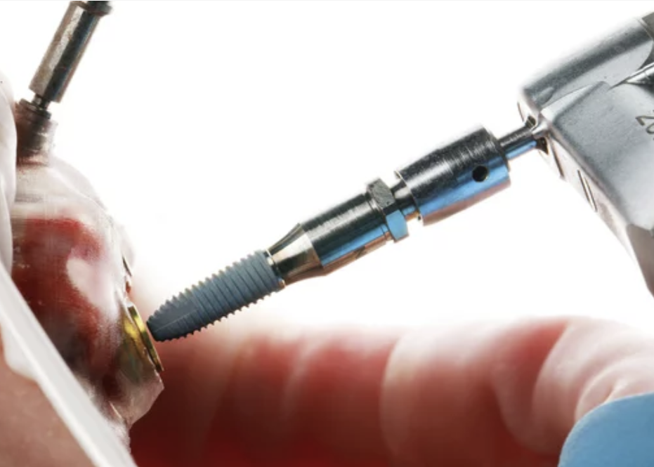 최소 침습 치료