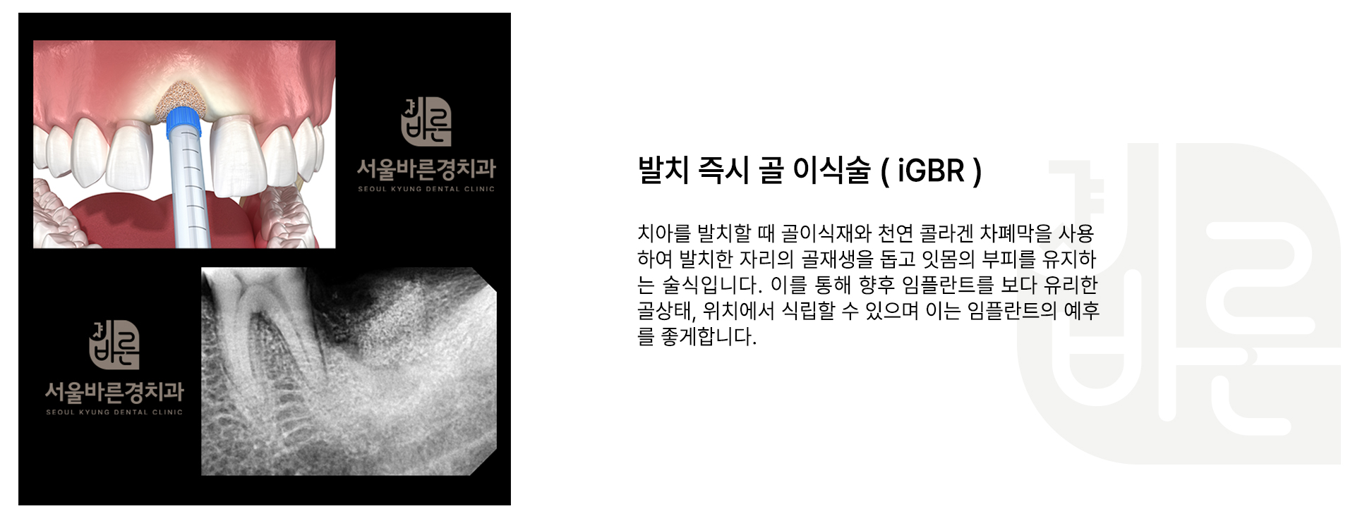 슬라이드 4