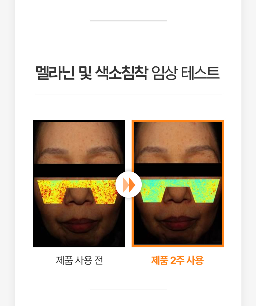 바이퓨로 스팟 트라넥삼산 나이아신 크림 제품명을 중심으로 피부 톤 케어 이미지를 강조한 타이틀 컷