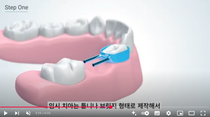 연산동치과추천 동래치과추천 부산치과추천