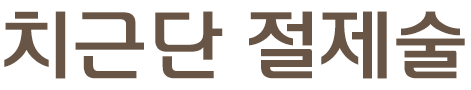 치근단절제술