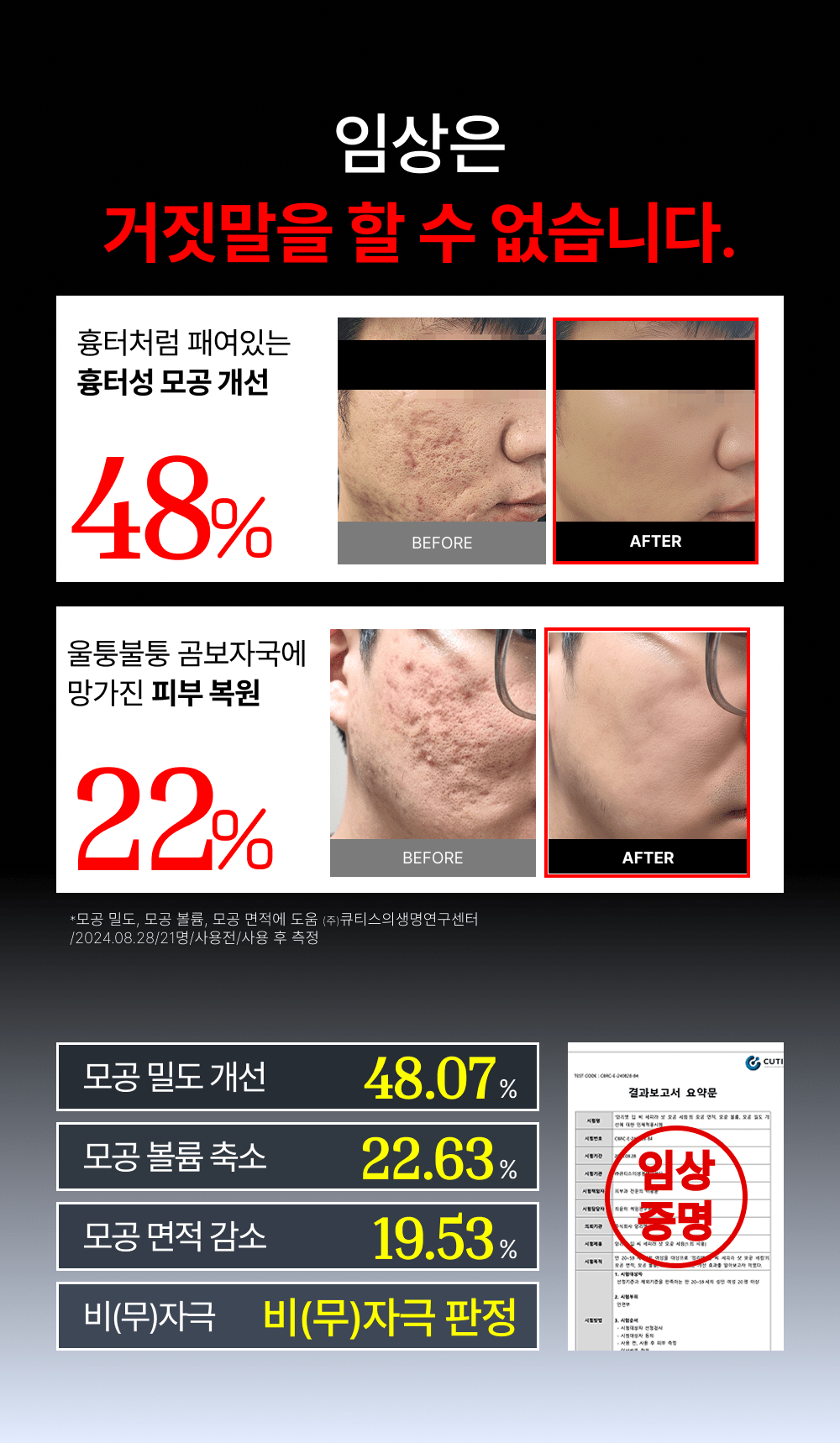 2시간 뒤 가격 상승💸 흉터성모공 개선 실험 성공! 피부과 모공슈링커 비밀특가