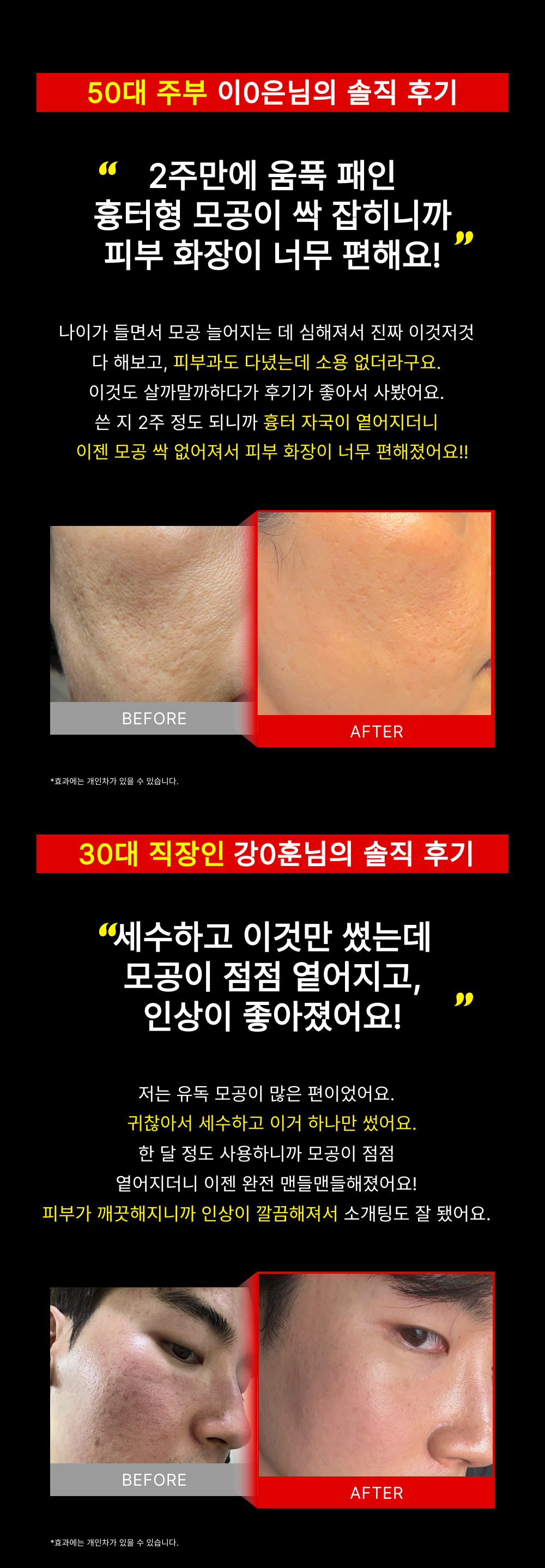 2시간 뒤 가격 상승💸 흉터성모공 개선 실험 성공! 피부과 모공슈링커 비밀특가