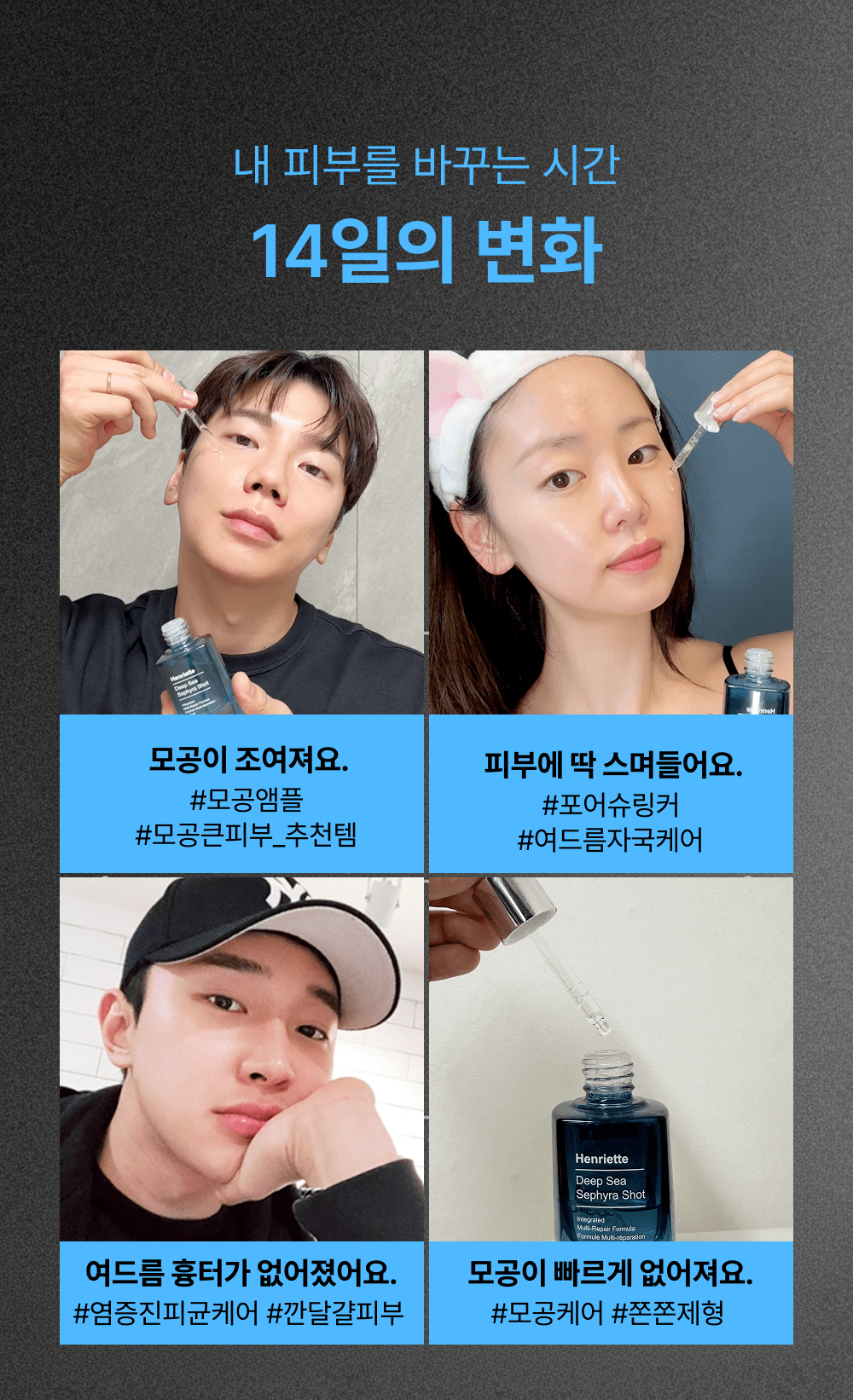 2시간 뒤 가격 상승💸 흉터성모공 개선 실험 성공! 피부과 모공슈링커 비밀특가