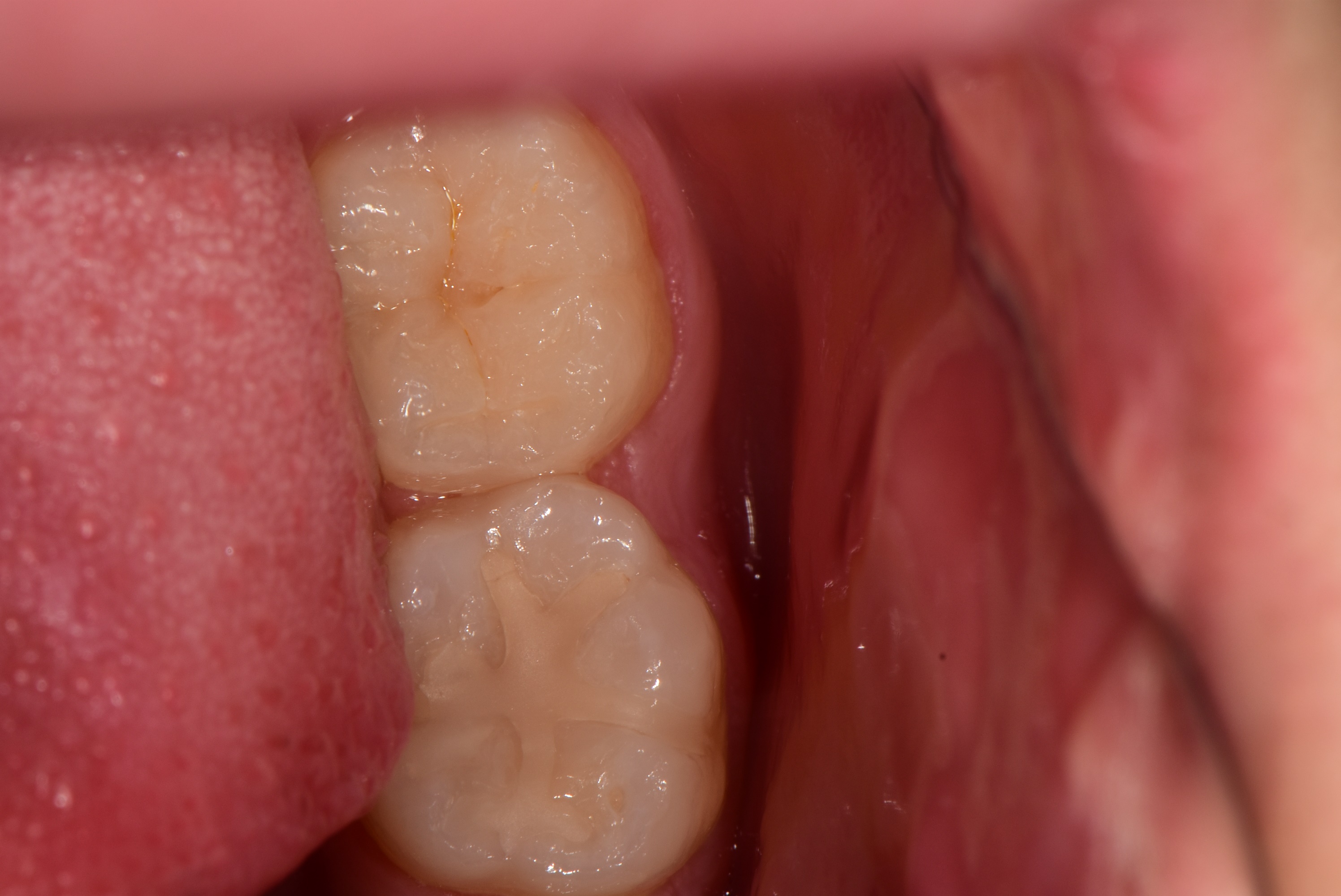 4ca0e2feb3a17.jpg