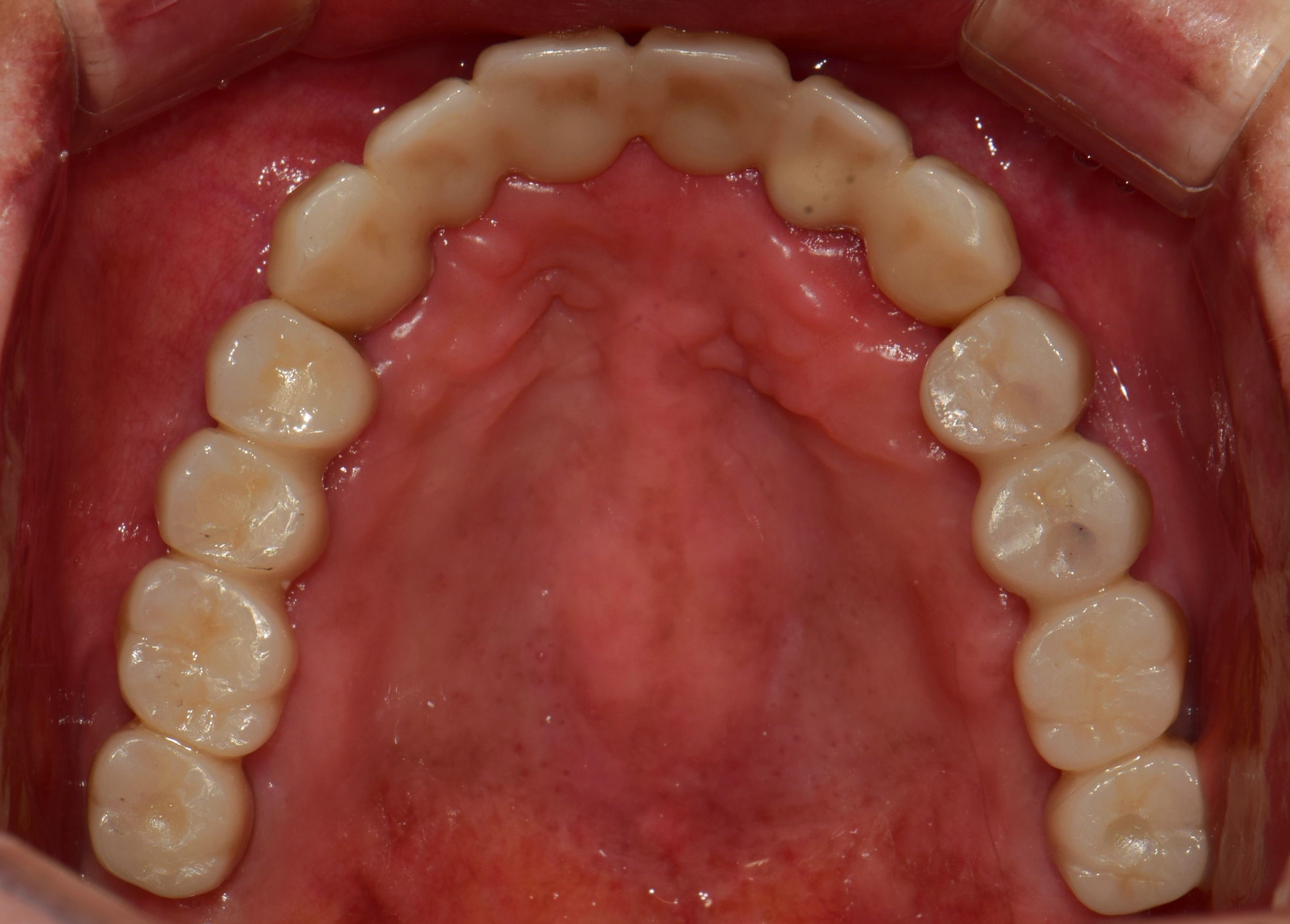 9b1c2745d8097.jpg