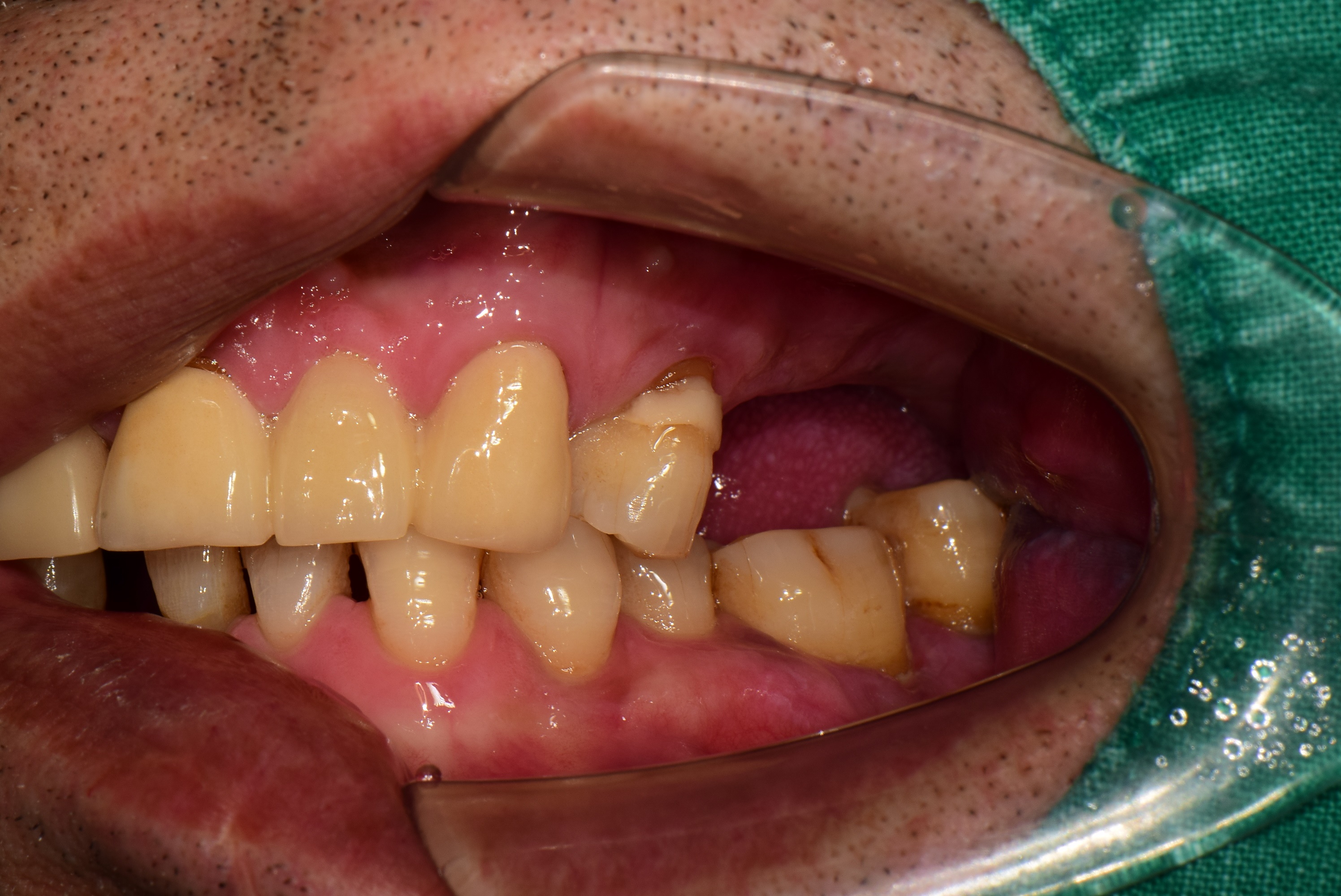 a3a680db2a107.jpg
