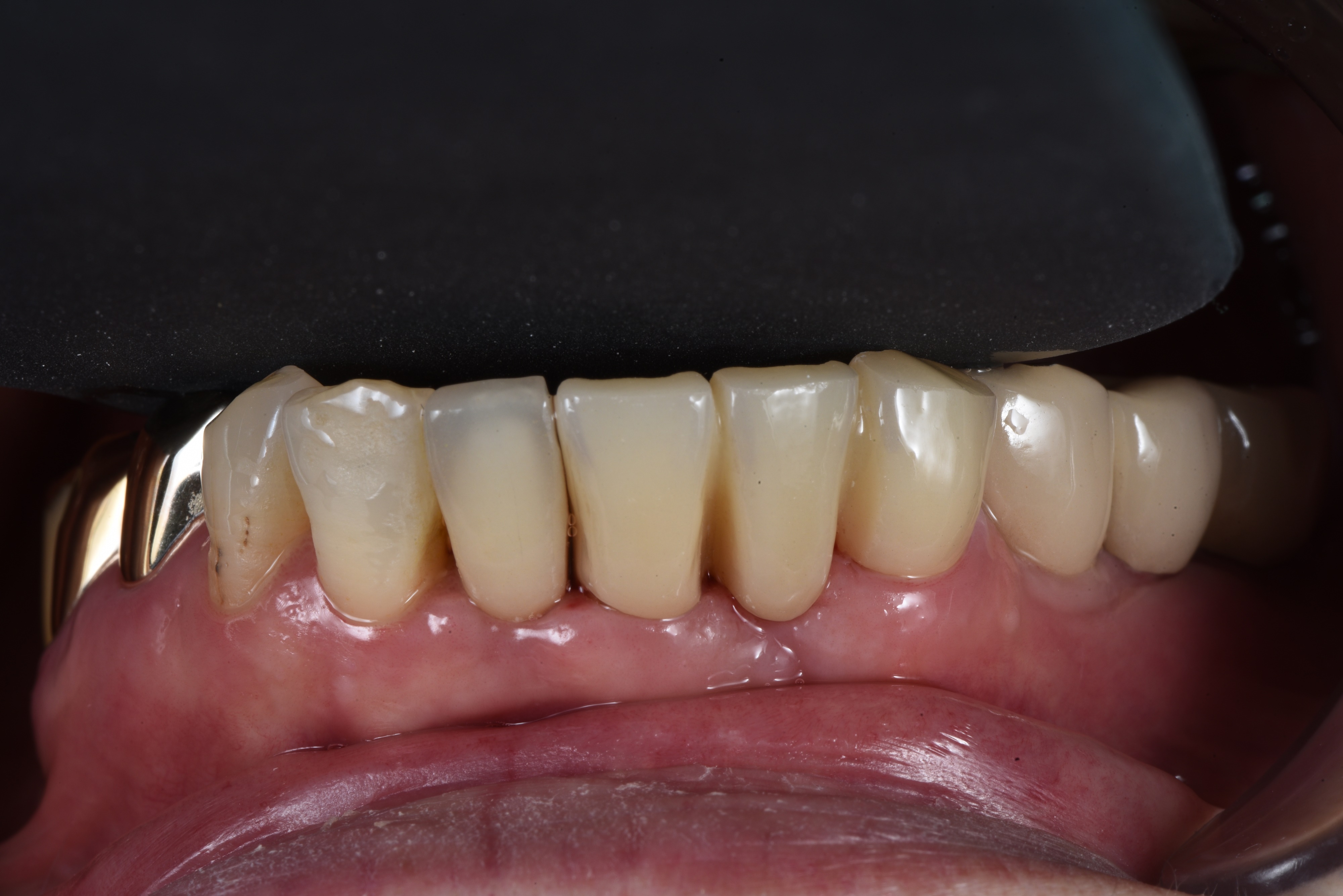 bac18b8094702.jpg