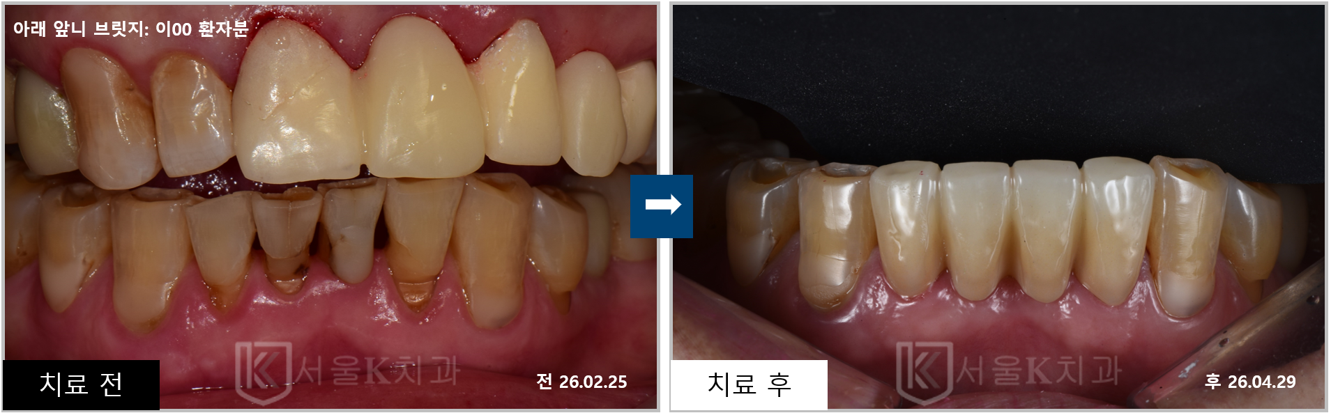 cc70e970a6bcd.png