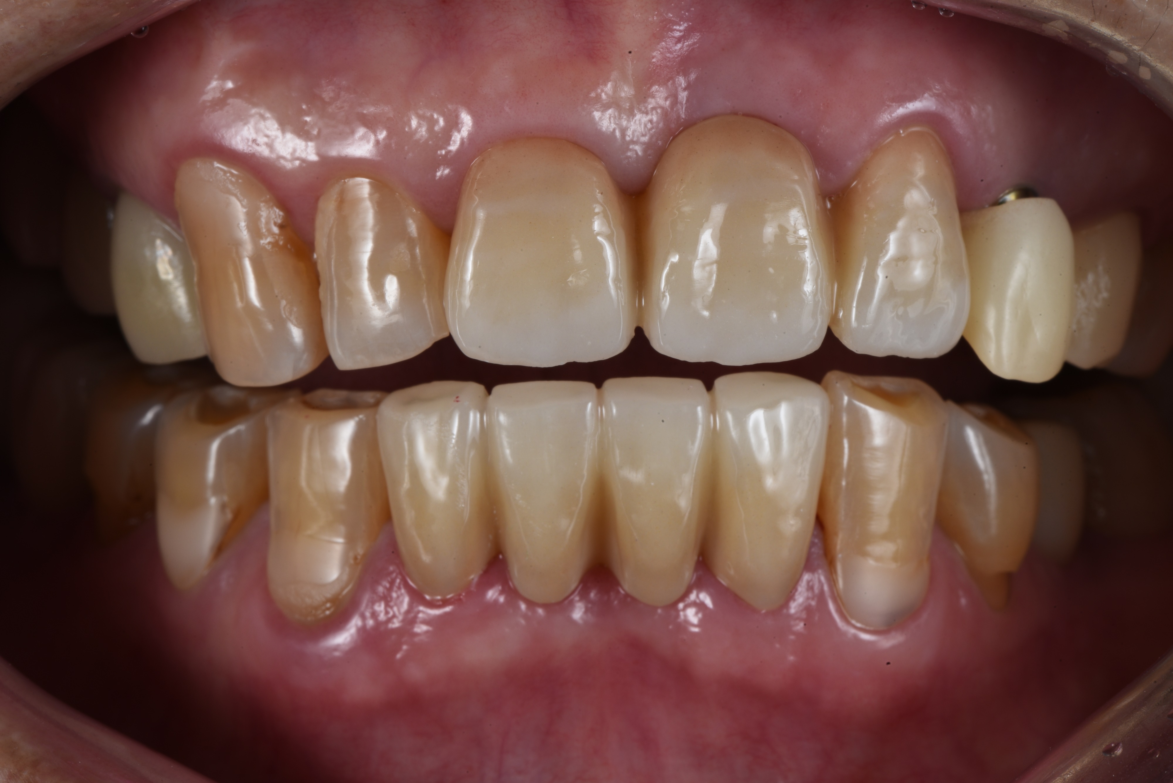 cf52dcd44334d.jpg