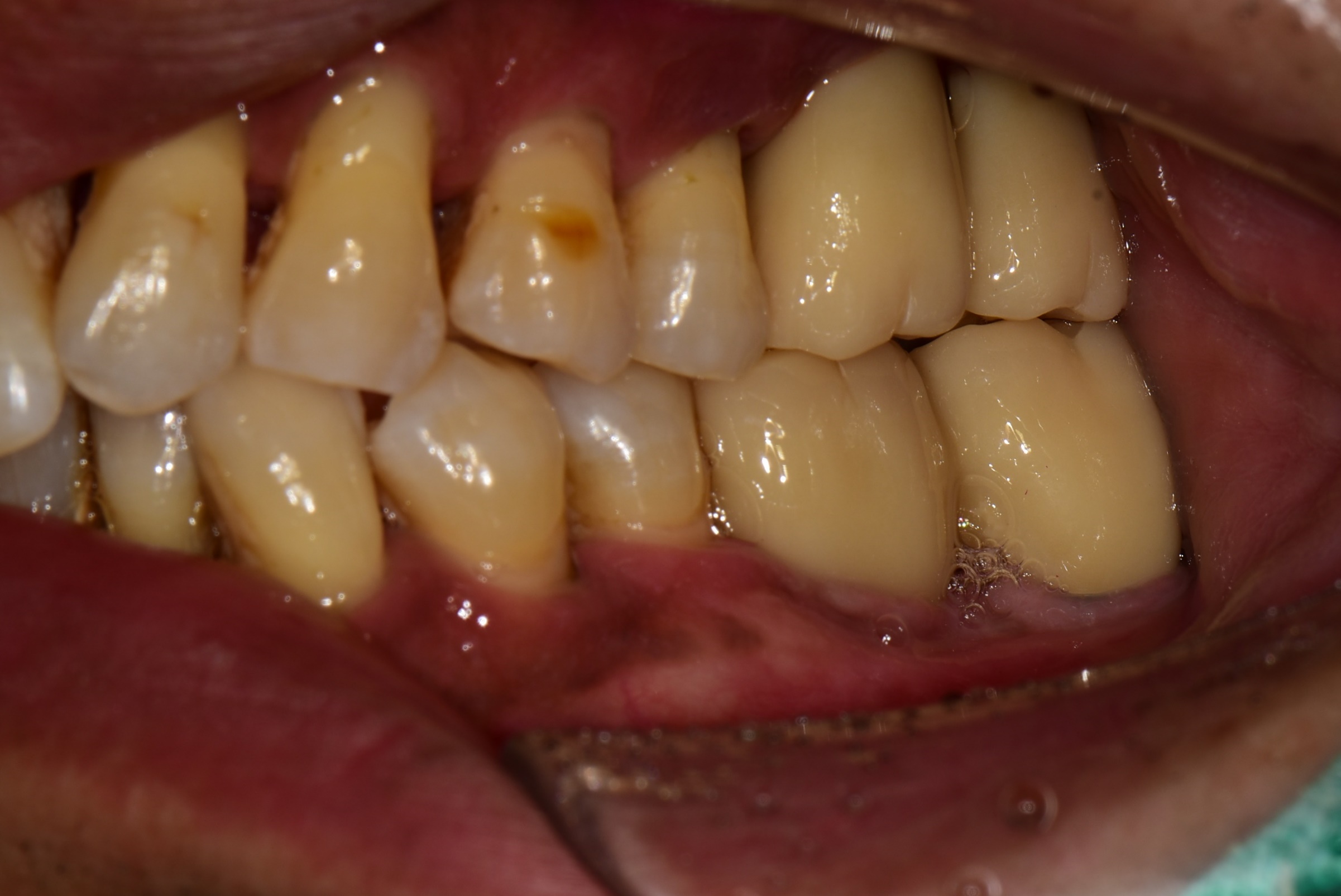 d2733a9bcebdf.jpg