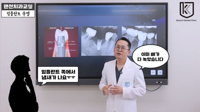 임플란트 수명에 대하여 서울케이치과 대표원장이 직접 설명하는 사진