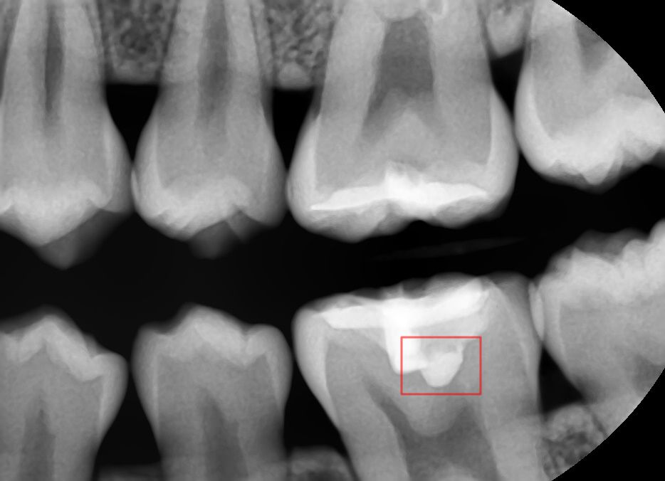 f4976f13c6704.jpg