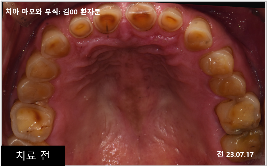 f92ee42a035ec.png