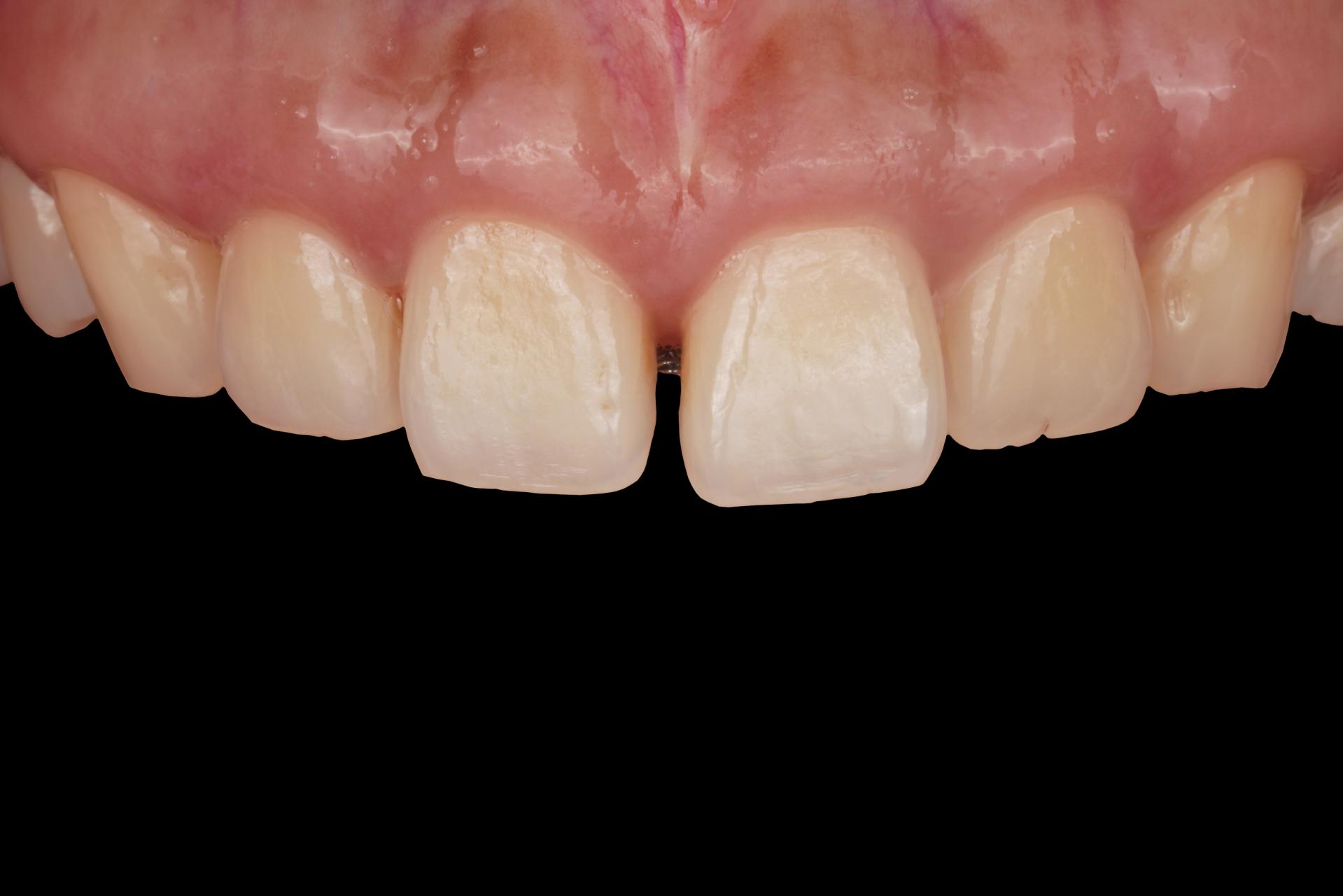 012587d57f984.jpg
