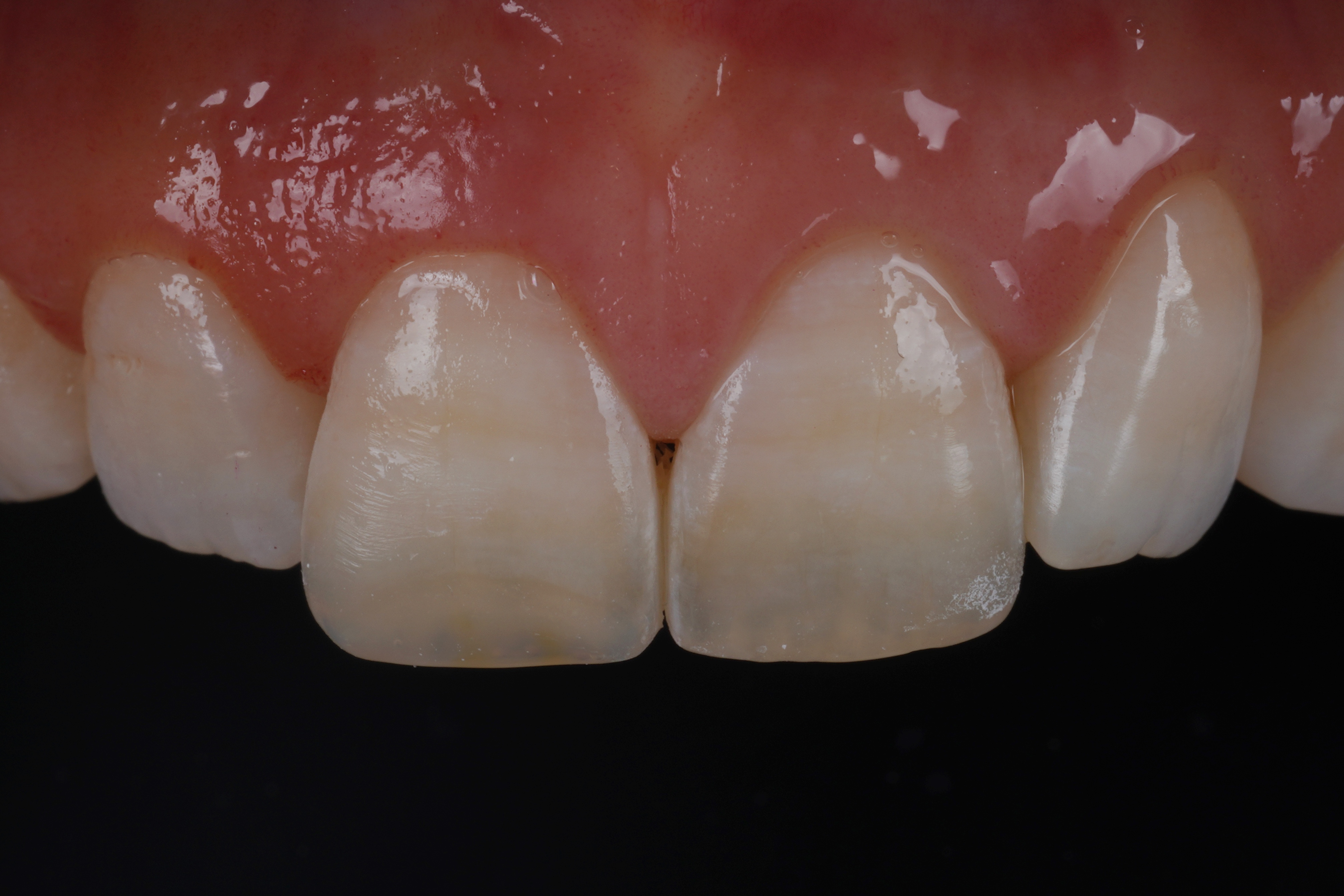 17bf50ba21360.jpg
