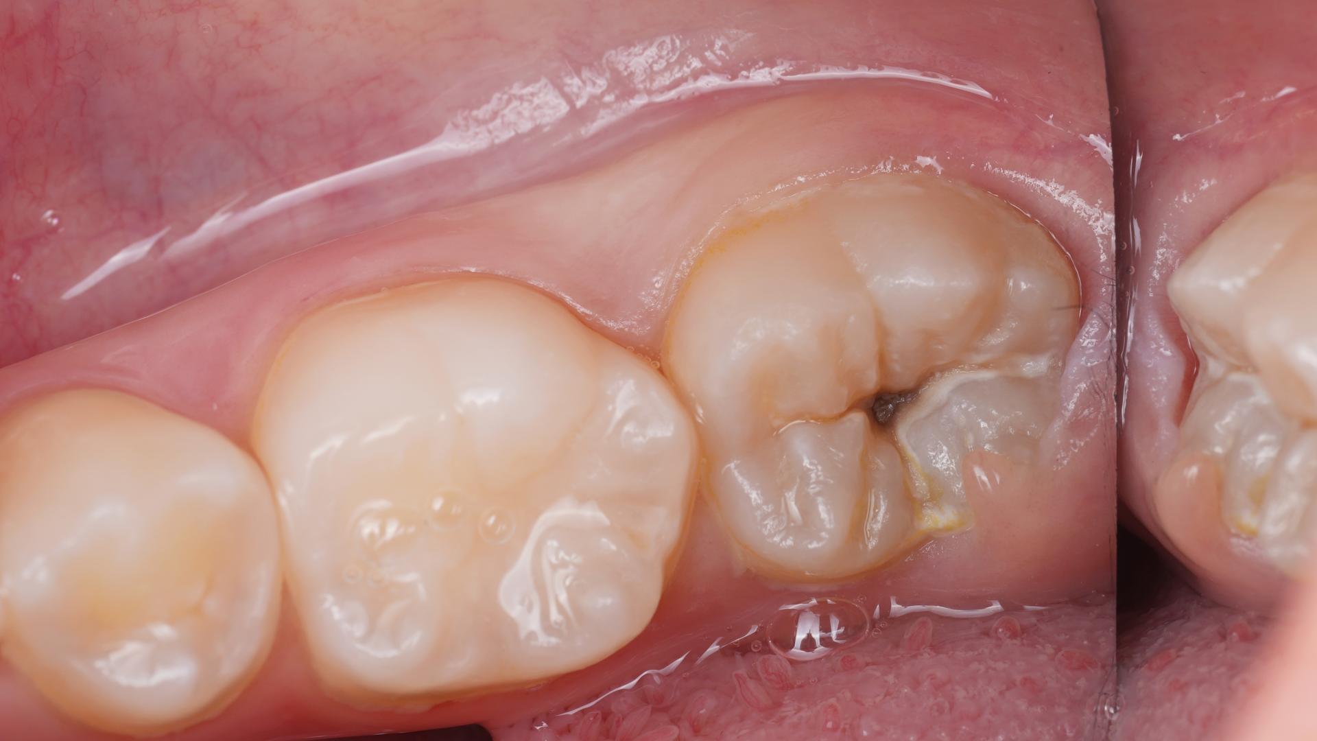 20dc4481c782f.jpg